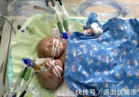 怀孕|怀孕20周,四维彩超却发现胎儿畸形,闻到孕妇身上的味道明白了