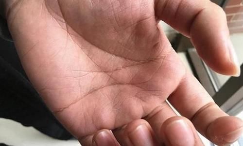 长期吸烟的人，身体会怎么样？若出现2处变粗，说明你该戒烟了