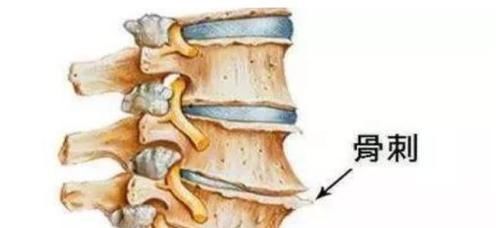 体检|很多病都不算病，只是人老了，这4类疾病无需过度治疗，不用担心