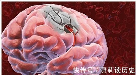 血压|“中风”为何越来越多?直言:改掉饭后3个习惯,脑血管会更健康