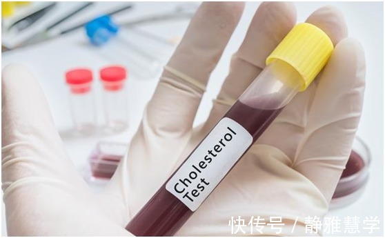疾病|患上高血脂的危害有哪些好好学习,全都是知识点呢