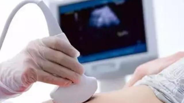 四维彩超|怀孕后总是小心翼翼闯过了这6关孕检,孕妈就可以松口气了