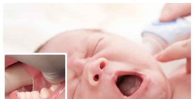 奶奶|宝宝1岁不会说话，奶奶怀疑没给孩子剪舌根，医生：回去吧治不了