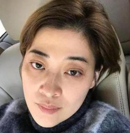 眼霜|什么叫一双眼睛“毁”一张脸?若出现3个问题,五官再精致也白费