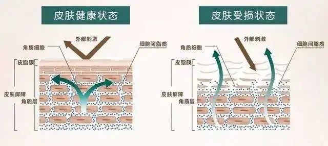 皮肤|风很大的“以油养肤”，是智商税吗？