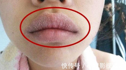 气血|肝病偷袭,“嘴”先报告,4个症状一目了然,希望你一个不占