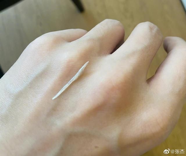 鱼骨|张杰吃鱼鱼骨卡在食道里，网友：你吃的什么鱼，谢娜在和你抢吗？