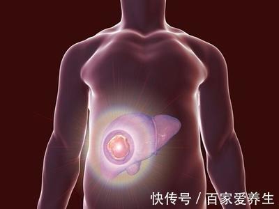 肝脏|67岁大爷,从肝硬化到恢复正常,1物适当补充,肝脏自己变“软”