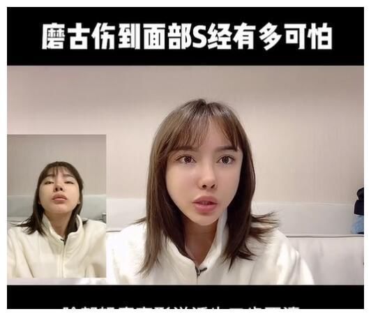 真实颜值|美女网红花70万却整形失败,磨骨伤到神经毁容,自叹非常后悔