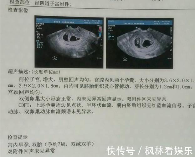 夫妻俩|生了3个孩子又怀上双胞胎，宝妈气得摔东西生那么多孩子干啥