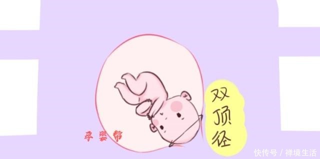 胎儿双顶径太大无法顺产,孕妇一个举动及时补救,连医生都称赞!