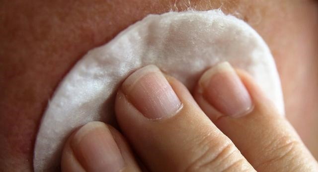 孕妈们|怀孕后孕妈皮肤普遍变差,但是,这类孕妈是个例外