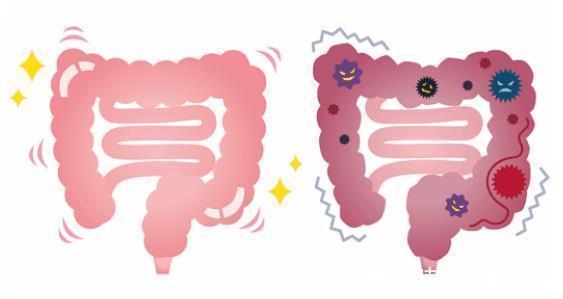 腹泻|经常腹泻、便秘医生养护肠道,只需做到3点,轻松找回益生菌