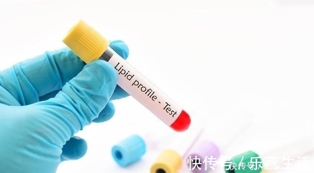 血液粘稠|体内“血脂”高?3样“东西”尽量少碰,血栓可能躲着你