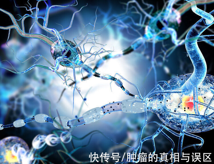 肿瘤|癌症转移速度有多快？为啥有人很快就转移了？或和4个原因有关