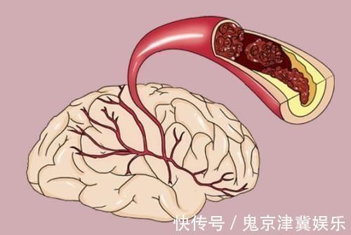 血糖升高|有糖尿病的人要远离豆腐?提醒:不想血糖升高,这3种素食要少吃