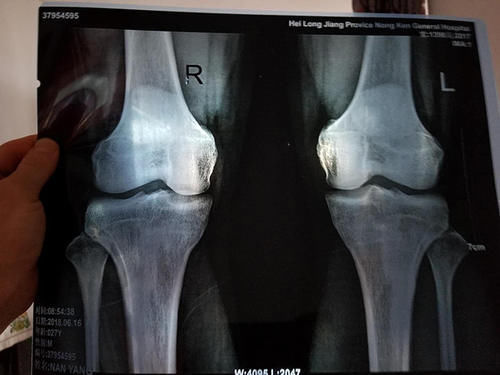 长身高|当孩子出现这3个信号,说明长身高进入倒计时,早发现早“冲刺”