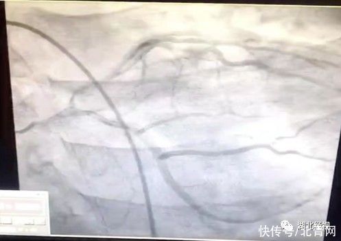 19歲小伙每天把這個當(dāng)水喝，住進(jìn)ICU搶救8天……醫(yī)生緊急提醒