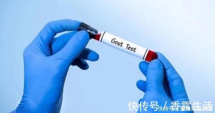 血压|血压、血脂、血糖、血尿酸参考值对照表,记得转给自己的家人