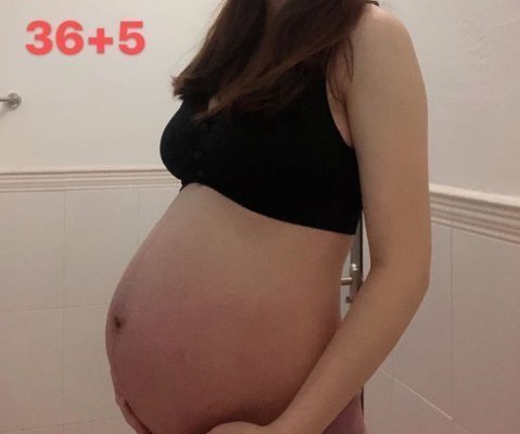 琳琳|“胎儿都有唇裂了，还成天抱手机”胎儿畸形受什么原因影响