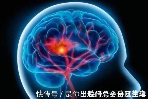 患者|脑中风的3个早期信号！你身边有这些表现吗？
