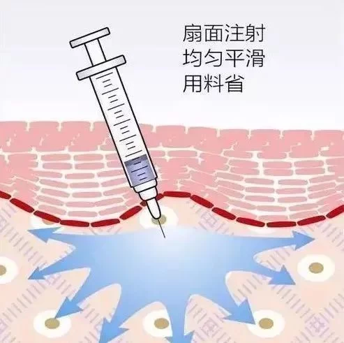 微整