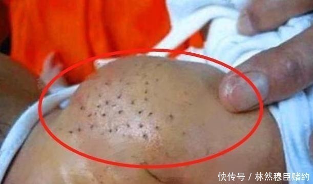 孩子|刚出生宝宝身上有“黑刺”,宝妈细心全拔掉,医生斥责太无知