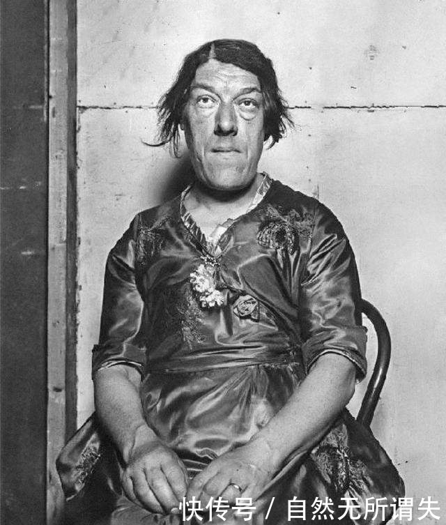 母亲|“怪物”玛丽:为了孩子参加选丑比赛,用自己的外貌换取金钱