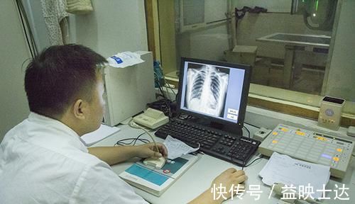 肺结核|做肺部CT时，发现阴影是不是肺内有癌了？医生：还有3个可能