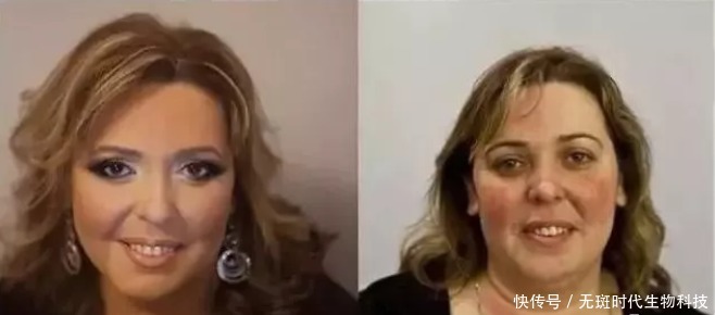 美肤祛斑,无斑时代用妙招还你美丽容颜