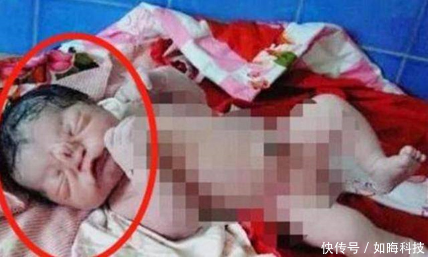 高龄|50岁产妇生下“猪八戒”,遭全家人嫌弃,医生的反而一句话救了娃