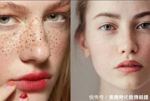 实验室|无斑时代PH450代谢酶科技祛斑,看完才知道值得