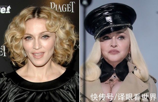 手术 美国整形医生警告,3种手术会让你看上去像大牌女星,这不是赞美