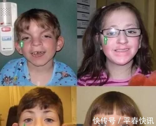 艺伎|宝宝长得太漂亮也是一种病?“歌舞伎综合征”到底是个什么鬼