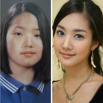 整容 歪脸女孩整容逆袭成女神,舍百万年薪当老师,这才是整容的意义