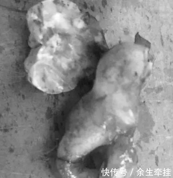 小李|小伙几年不刷牙脸发肿,张开嘴后医生却想吐:这是什么味儿!