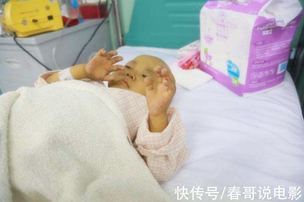 剖腹产|9个月女婴“剖腹产”生下胎儿，真相令人惊讶，孕期不可太大意