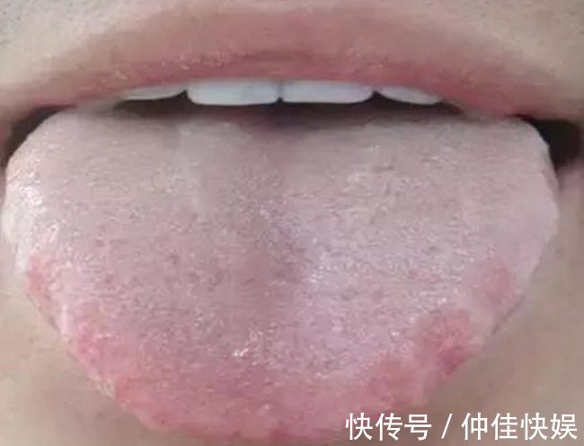 体质|舌是脏腑“本色反映”,8种体质,8种舌象,老中医教你怎么望舌