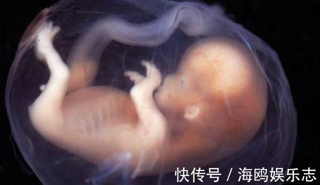 肚子|胎儿易发生脐带绕颈,''帮凶''竟是孕妈这3种习惯,别再坑娃了