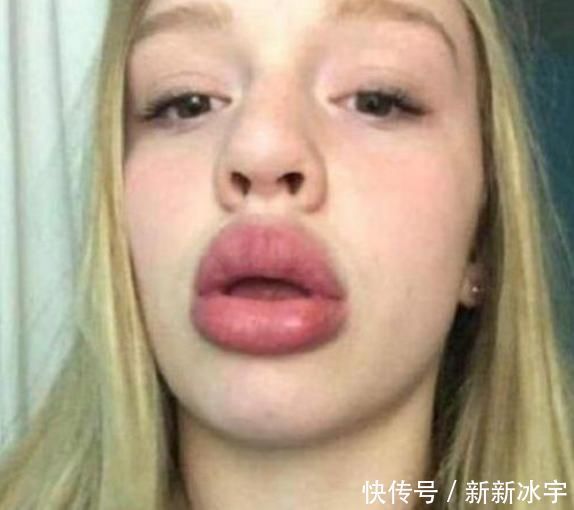 女孩子想变“樱桃唇”,3个恶习趁早改,否则“火锅嘴”没人爱