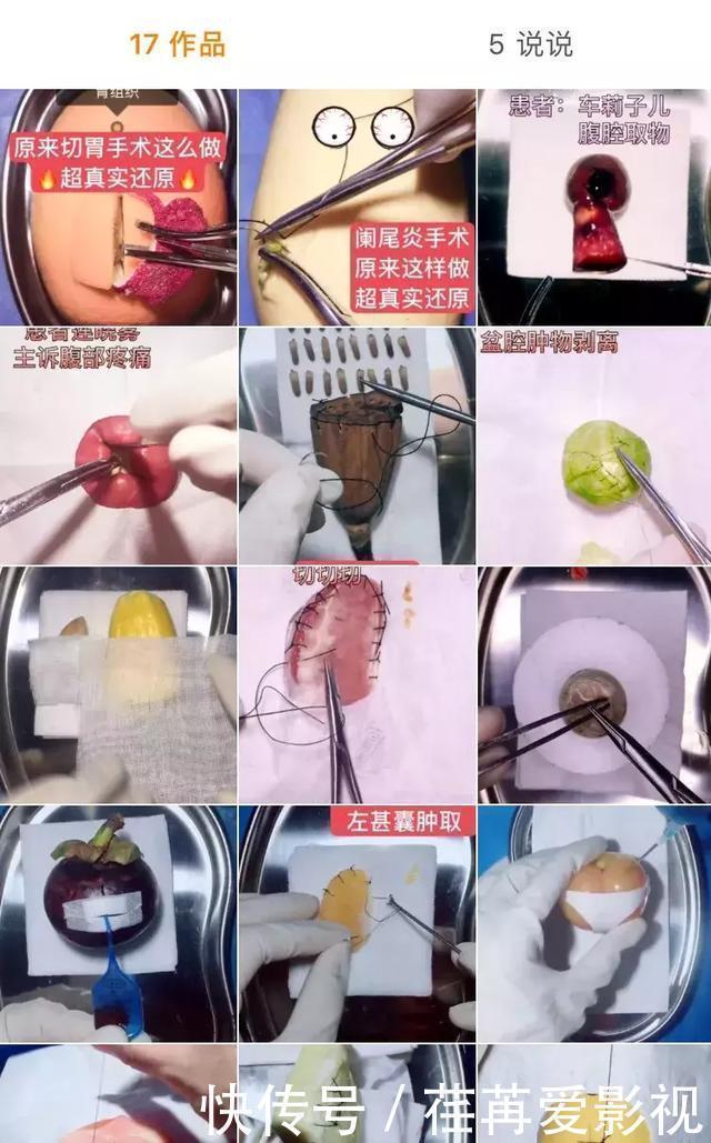 王醫生|32歲醫生竟給水果做手術？一夜吸粉12萬！網友：“我的膝蓋跪爛了”