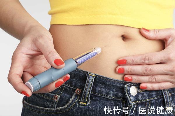 运动|糖尿病患者运动时,要注意4个细节,或能有效的降血糖