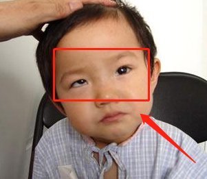 孙女士|6岁孩子常玩这玩具,导致黑眼珠逐渐消失,家长要当回事