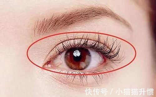 扁鹊内经|肝若硬化，头先知？头部若出现5个异常，建议：去医院做肝CT检查