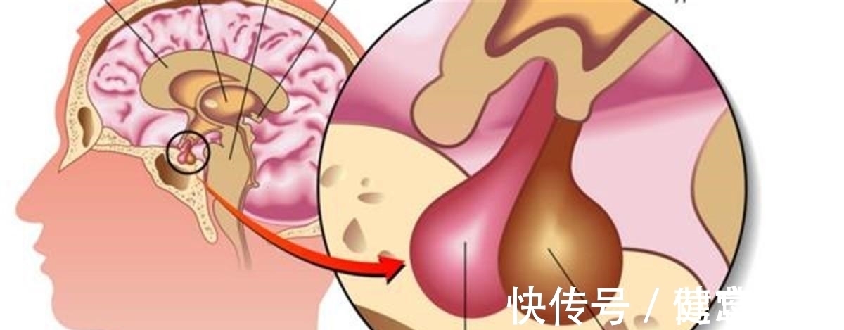 侏儒|雷纳尔:前半生是1米22的侏儒,后半生是2米16的巨人,他经历了啥