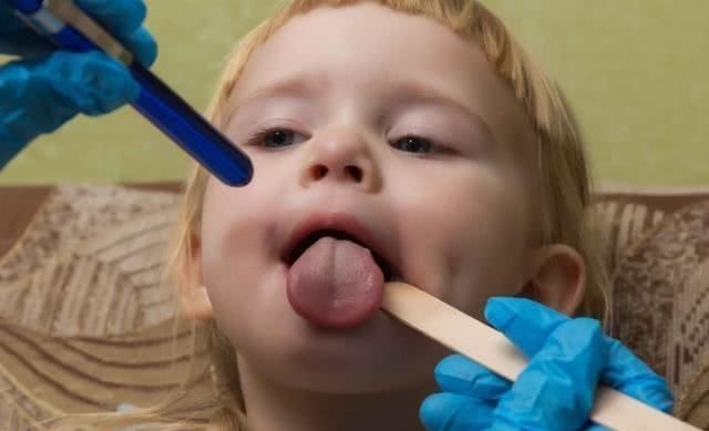 咳嗽|是风寒还是风热孩子咳嗽有痰,医生教你看这8个现象来辨别