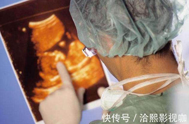 尿液|年轻孕妈做四维彩超,一看画面医生笑出声,孕妈羞红脸尽干坏事
