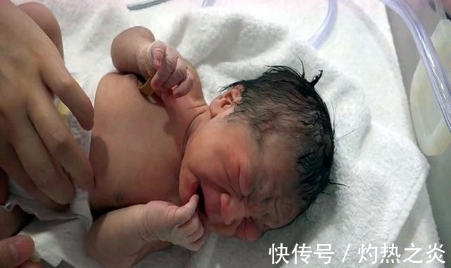 福气|宝宝身体这几个部位有痣,可能是有“福气”的表现,你家娃中了没