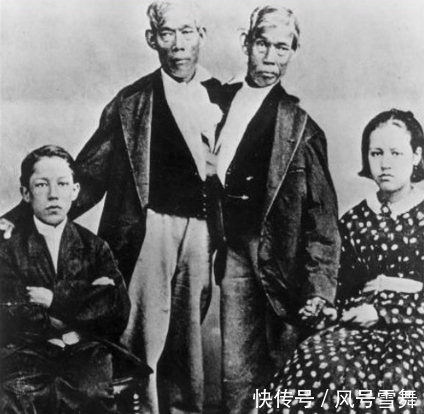 姑娘|连体哥哥爱上英国姑娘,弟弟每次只能回避,姑娘想一招三人都幸福