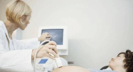 方女士|36岁孕妇进产房前要大便, 幸好医生阻拦保得母子平安